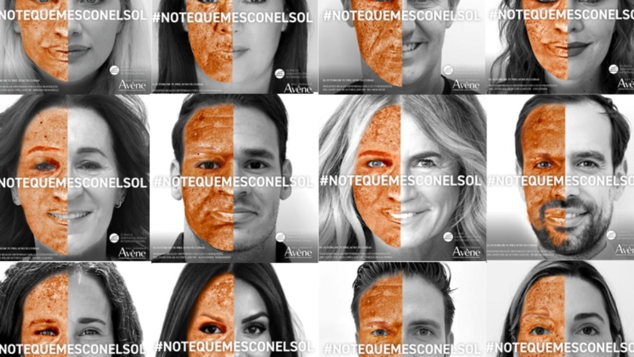 #Notequemesconelsol2022, una iniciativa del Hospital Ruber Internacional y Clínica Dermatológica Internacional para prevenir el cáncer cutáneo k2_items_src_22e0f27f718beb2c1f57cf0e3dece31b