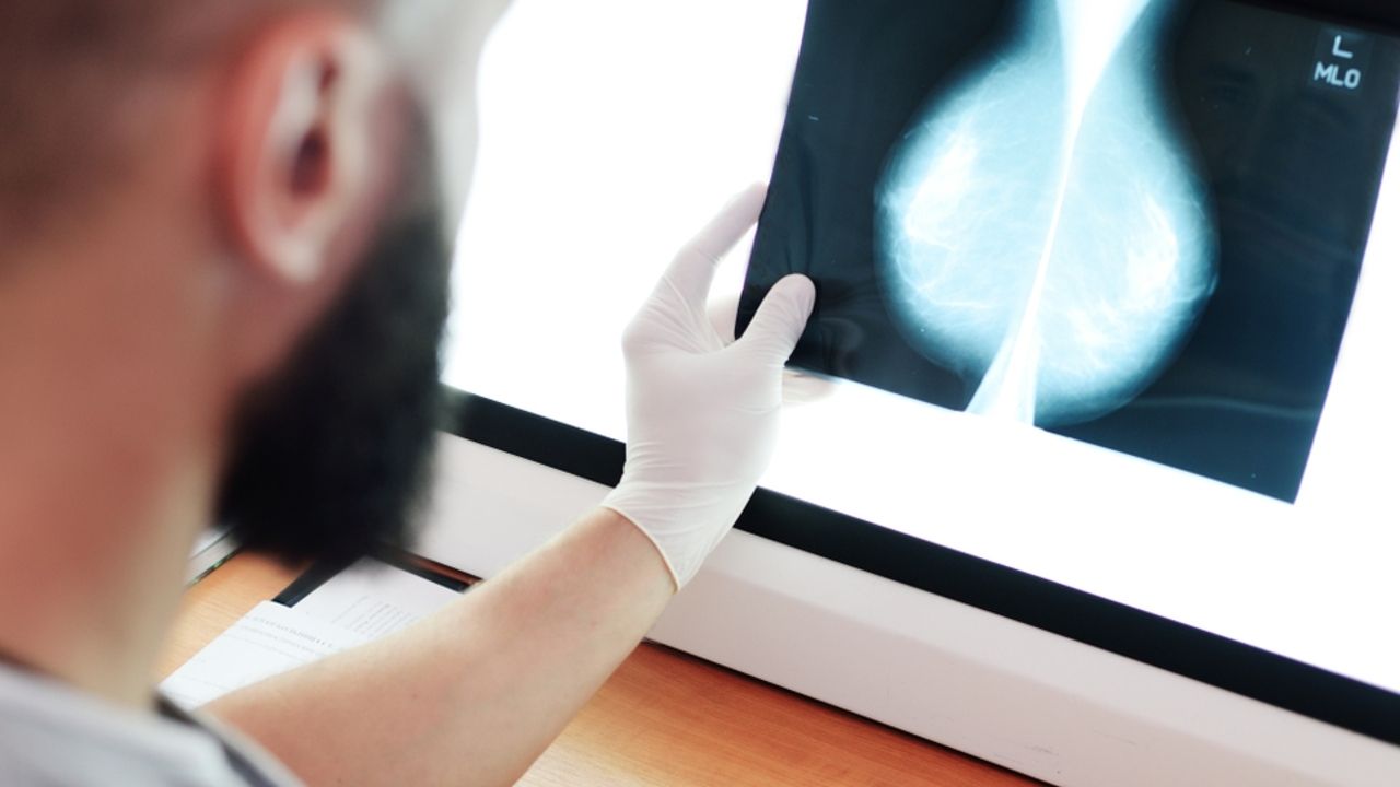 La mamografía con contraste o la RM están generando resultados muy prometedores que orientan a personalizar los cribados según los perfiles de riesgo usando la mejor tecnología k2_items_src_bbf41833b752756eb34a4e07961dc06c